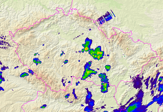 Radar