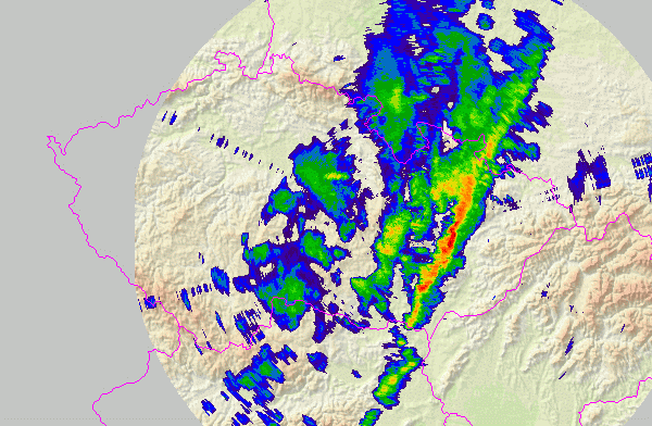 Radar